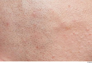 HD Faec Skin Doe Irish cheek face skin pores skin…